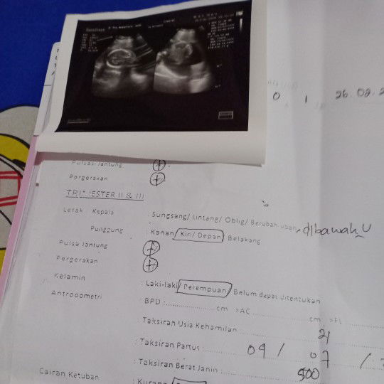 jenis kelamin berubah2 ato tidak?