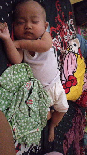campak
