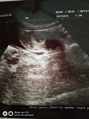 11w4d