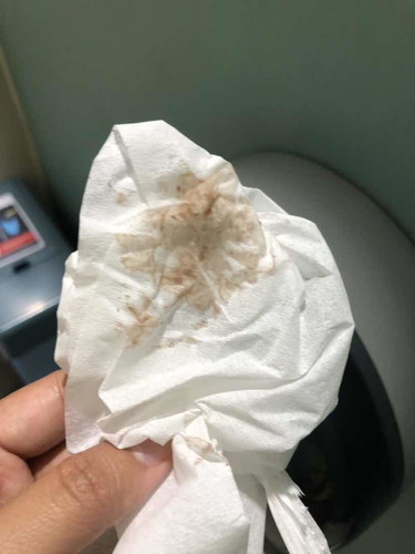 เลือดออก ตอนท้อง 5 w