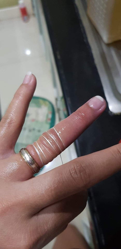 HELP!!! WEDDING RING IS STUCK