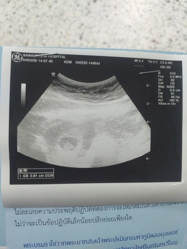 สอบถามหน่อยค่ะ??