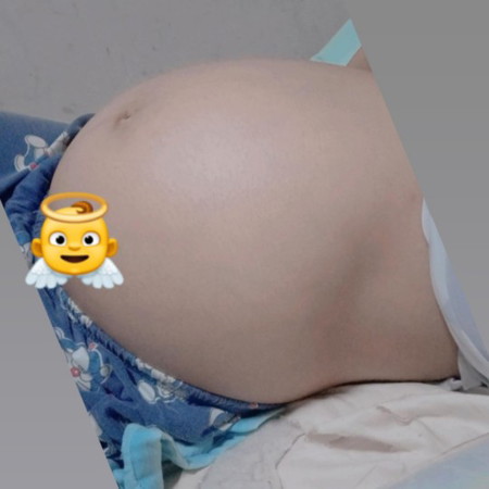 36W5D