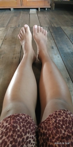 kaki bengkak