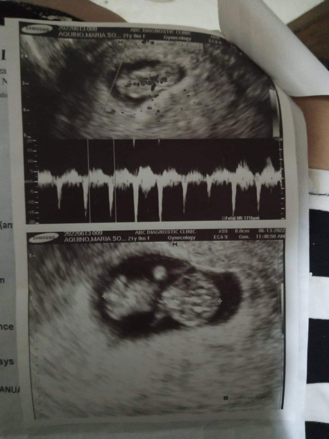 Sophia Aquino profile icon