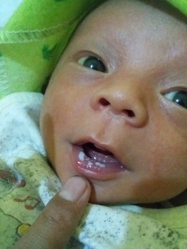 ada yg tau gk bun ini knpaa ya..takutnya knpa2 .cara menghilangkn nya gmna ya bun.mksh yg udh menjwb??