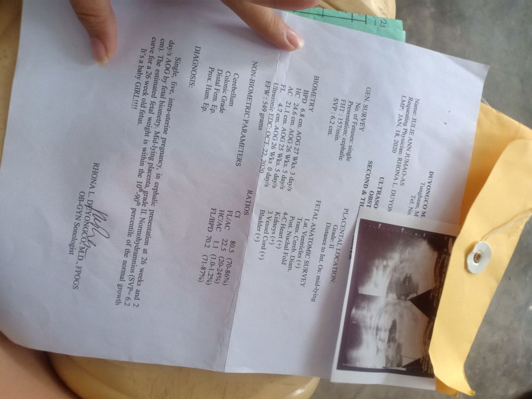 its a baby girl 🥰