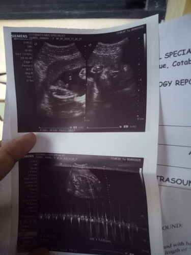 Gender 28 weeks and 2 days