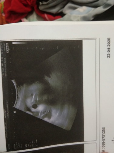 ลูกหาว