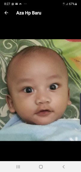 apakah bayi saya juling?