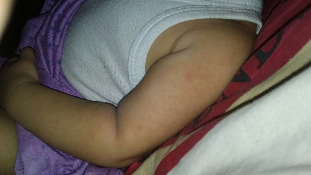 tampek atau biang keringet