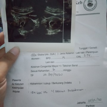 Jatuh di kamar mandi