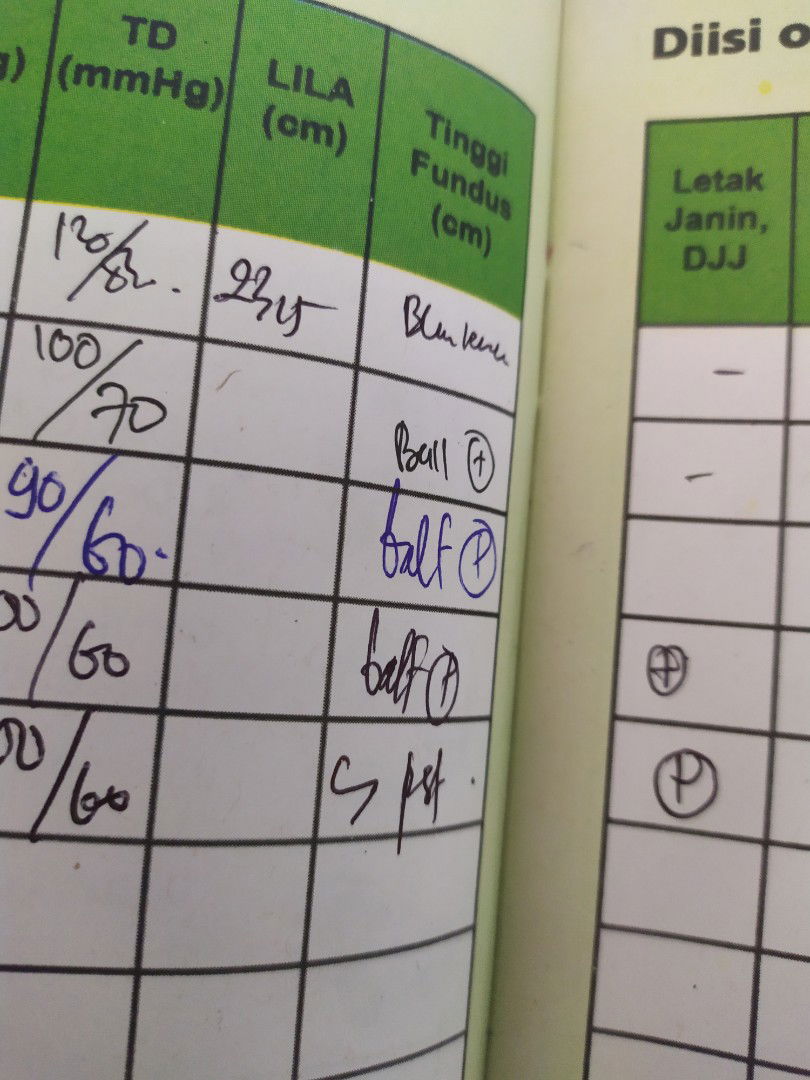 arti tinggi fundus seperti huruf s