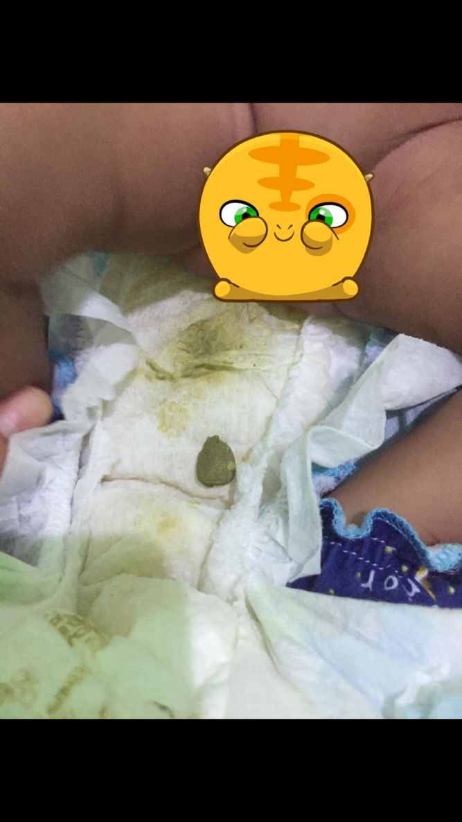 Bayi sufor + asi susah BAB