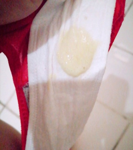 Is This Mucus Plug?