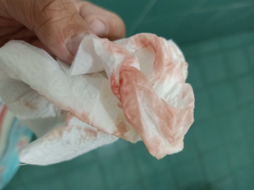 ถ้าออกแบบนี้คืออะไรคะ