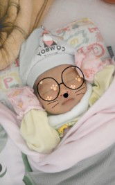 ngực không cân đều