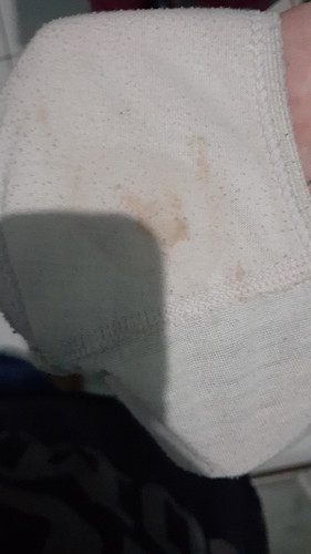 flek atau pendarahan