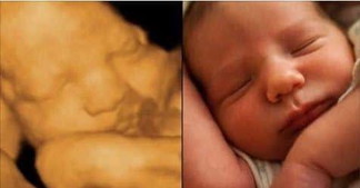 When can altrasound 4d for see baby
