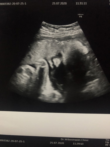 31w