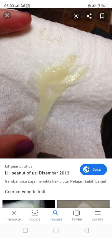 keluar lendir saat kencing