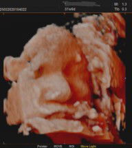 Tieu My Dinh profile icon