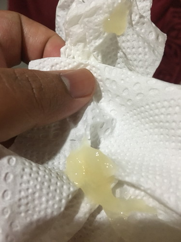 39สัปดาห์