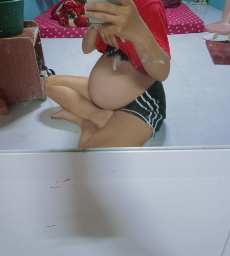 คลอดก่อนกำหนด