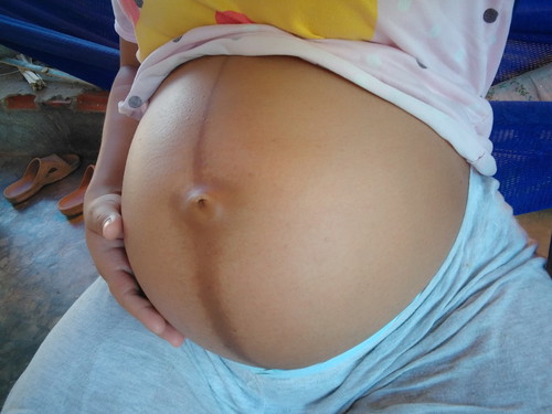 ขอความคิดเห็นแม่ๆ