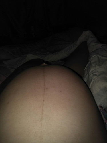 38+2