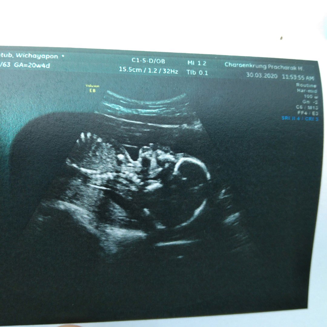 Vichayaporn Komm profile icon