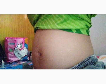 19w+3ค้ะท้องเล็กไปไหมค้ะเเม่ๆ