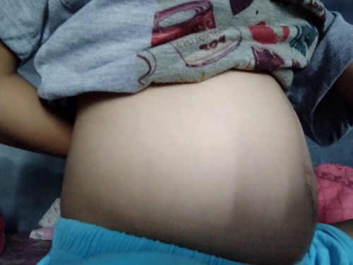 กำหนดคลอด