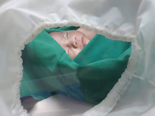 ผ่าคลอด 37+4 กำหนดจริง 15 พ.ค.