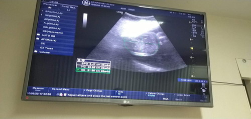 ขอดูภาพอัลตร้าซาวด์ แม่ๆหน่อยจ้า  บ้านนี้27+1w