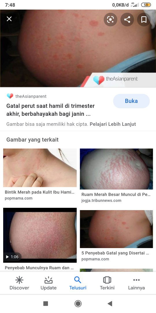Ruam merah gatal di perut dan kaki