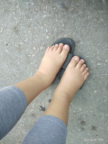 คลอดแบบไม่ได้ตั้งตัวผิดคาดใน ผิดคาดอีกที