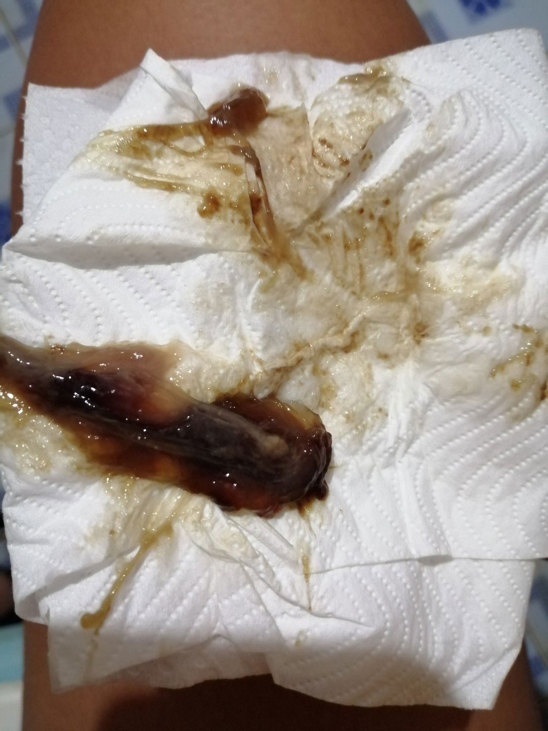 มีมูกเลือด