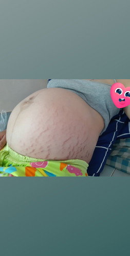 38+1 w ท้องแรกคะ