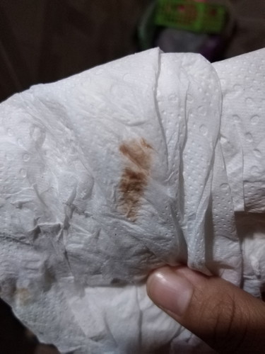 คุณแม่ท่านไหนเคยเป็นแบบนี้ไหมค่ะ