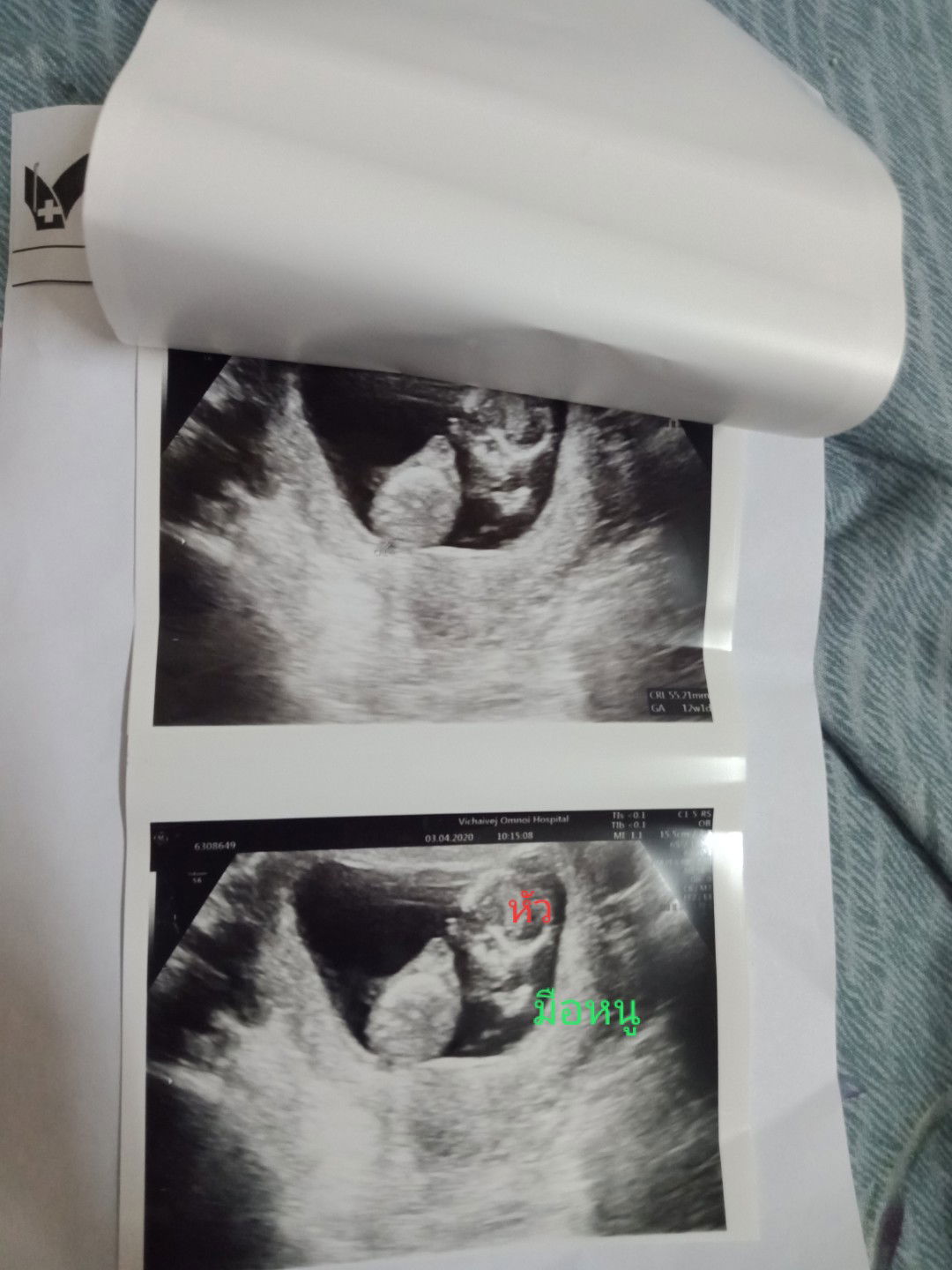 ดีใจที่เห็น