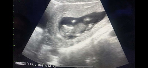13 weeks