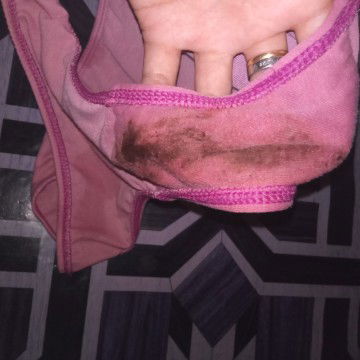 12weeks preggy.Normal lang po ba ito?