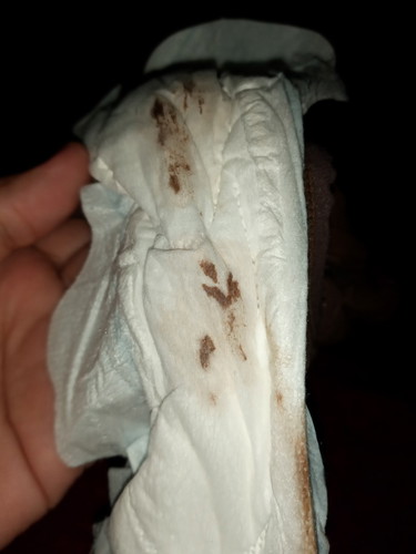 maaf sebelumnya bunda...kalau kesannya agak jorok..tadi malam aku sampai diang ini aku keluar flek bunda,saya hamil 6 mnggu,td udah konsul jg...dan di kasih obat penguat rahim ,,saya takut kenapa2 sama calon debay nya bunda