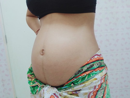 20สัปดาห์เเล้วจ้า..พุงเเหลมเชียว ช.ญ. รอลุ้นกันค่ะ❤️