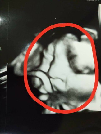 ดูทำหน้าสิ