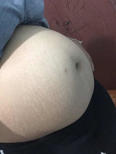 มีคนทักว่าท้องเล็ก