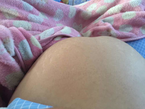 เพศลูก