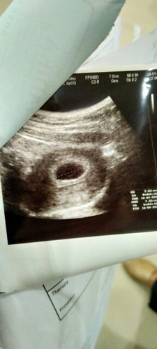 kehamilan 6 week