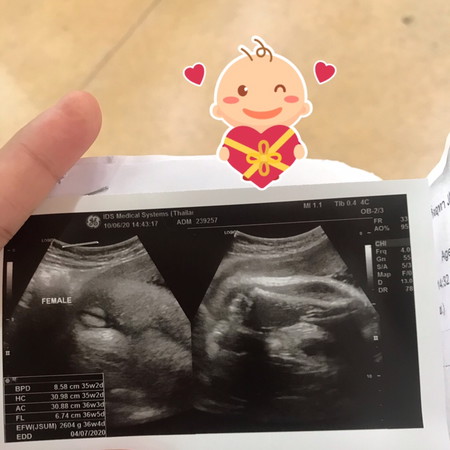 แม่ๆได้ลูกสาวหรือลูกชายกันคะ